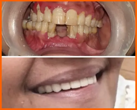 افضل دكتور عيادات زراعة اسنان في سعودي عربية